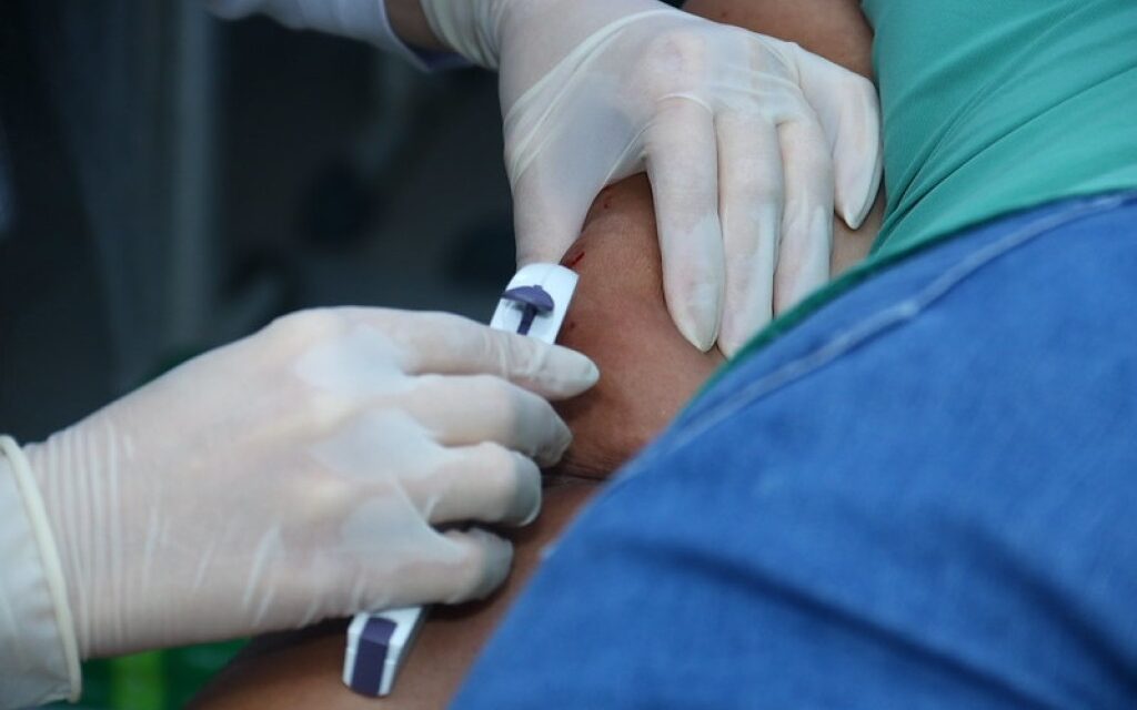 Redução de filas: Sinop recebe mais de 5,8 mil implantes contraceptivos e descentraliza planejamento familiar nas UBSs
